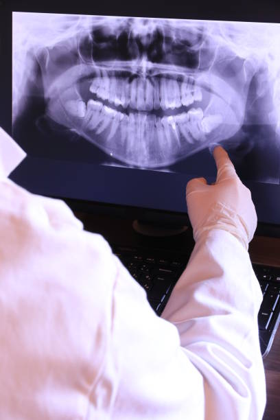 Best Emergency Root Canal Therapy in Trent Woods, NC